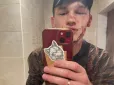 Приїхав відпочити від фронту, але: На Черкащині побили військового на реабілітації